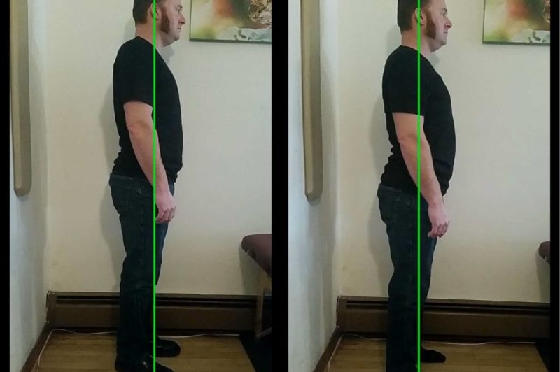 Pain Relief by Posture Correction - True Healing and Wellness